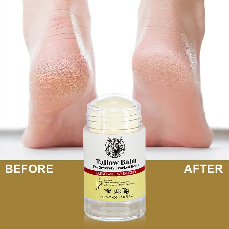 Foot & Heel Care thumbnail 21