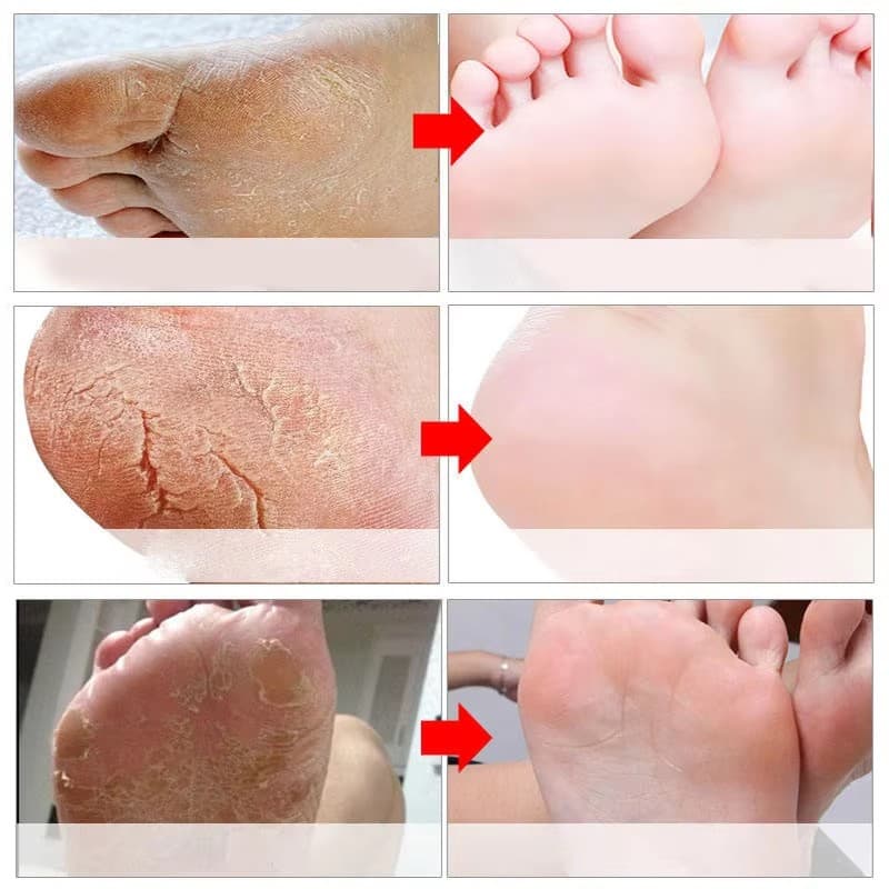 Foot & Heel Care detail 8